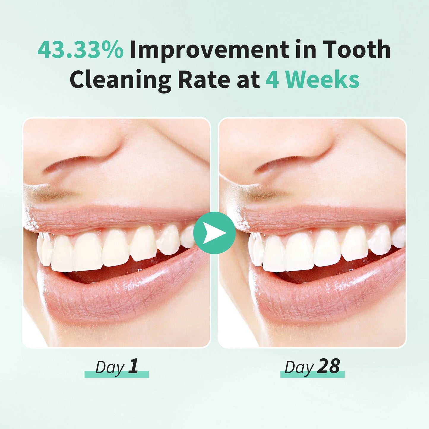 Sejoy Rechargeable Sonic Toothbrush 5 Cleaning Modes